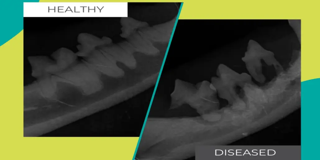Understanding Dental Diagnoses: How Modern Dentistry Identifies Oral Health Issues 3 1